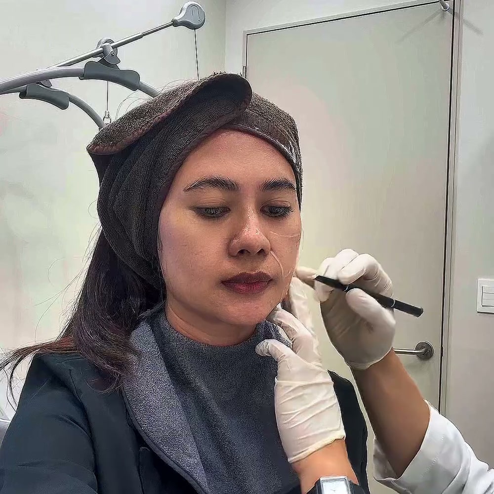 피부 관리를 받는 동안 시술자가 얼굴에 라인을 그리는 장면을 찍은 인도네시아어권 크리에이터의 컷